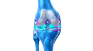 무릎 관절의 해부학적 구조와 통증 발생 부위 3D 일러스트